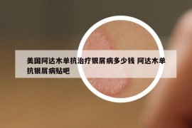 美國阿達木單抗治療銀屑病多少錢 阿達木單抗銀屑病貼吧