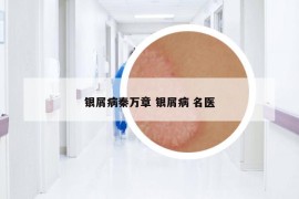 銀屑病秦萬章 銀屑病 名醫(yī)