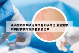 點滴型銀屑病消退期又有新疹出現(xiàn) 點滴型銀屑病好轉(zhuǎn)的時候又有新的出來