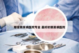那家銀屑病醫(yī)院專業(yè) 最好的銀屑病醫(yī)院