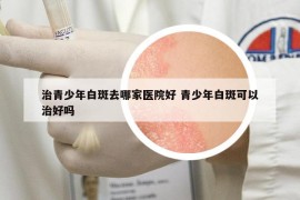 治青少年白斑去哪家醫(yī)院好 青少年白斑可以治好嗎