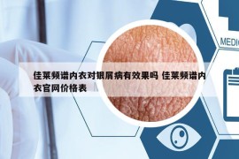佳萊頻譜內(nèi)衣對銀屑病有效果嗎 佳萊頻譜內(nèi)衣官網(wǎng)價(jià)格表