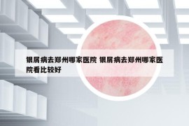 銀屑病去鄭州哪家醫(yī)院 銀屑病去鄭州哪家醫(yī)院看比較好