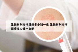 生物制劑治療濕疹多少錢一支 生物制劑治療濕疹多少錢一支啊