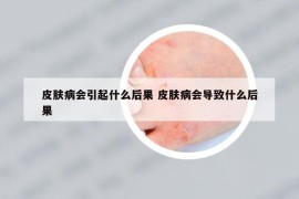 皮膚病會引起什么后果 皮膚病會導(dǎo)致什么后果