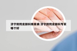 濟(jì)寧附院皮膚科銀屑病 濟(jì)寧附院皮膚科專家哪個(gè)好