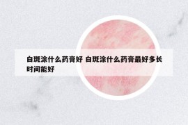 白斑涂什么藥膏好 白斑涂什么藥膏最好多長時間能好
