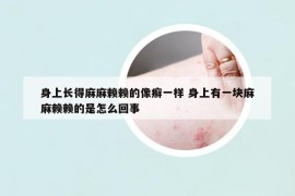 身上長得麻麻賴賴的像癬一樣 身上有一塊麻麻賴賴的是怎么回事