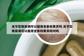 關(guān)節(jié)型銀屑病可以服用黨參和黃芪嗎 關(guān)節(jié)型銀屑病可以服用黨參和黃芪嗎對(duì)嗎