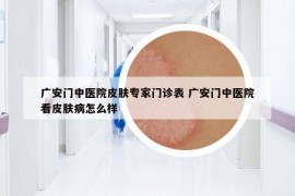 廣安門中醫(yī)院皮膚專家門診表 廣安門中醫(yī)院看皮膚病怎么樣