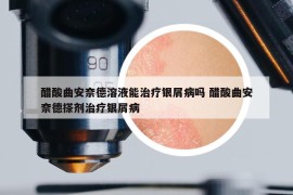 醋酸曲安奈德溶液能治療銀屑病嗎 醋酸曲安奈德搽劑治療銀屑病