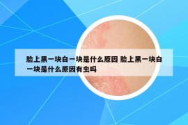 臉上黑一塊白一塊是什么原因 臉上黑一塊白一塊是什么原因有蟲嗎