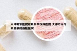 天津哪家醫(yī)院看銀屑病權(quán)威醫(yī)院 天津市治療銀屑病的最佳醫(yī)院