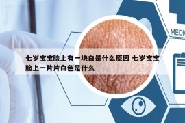 七歲寶寶臉上有一塊白是什么原因 七歲寶寶臉上一片片白色是什么