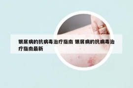 銀屑病的抗病毒治療指南 銀屑病的抗病毒治療指南最新