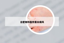 合肥哪所醫(yī)院看白癜風(fēng)