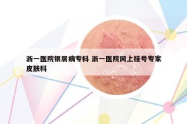 浙一醫(yī)院銀屑病?？?浙一醫(yī)院網(wǎng)上掛號專家皮膚科