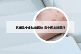 蘇州吳中皮膚病醫(yī)院 吳中區(qū)皮膚醫(yī)院