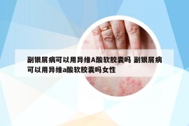 副銀屑病可以用異維A酸軟膠囊嗎 副銀屑病可以用異維a酸軟膠囊嗎女性