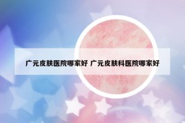 廣元皮膚醫(yī)院哪家好 廣元皮膚科醫(yī)院哪家好