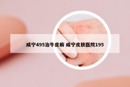 咸寧495治牛皮癬 咸寧皮膚醫(yī)院195