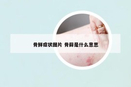 骨鮮癥狀圖片 骨蘚是什么意思