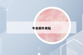 牛皮癬外用貼