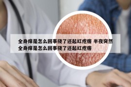 全身癢是怎么回事?lián)狭诉€起紅疙瘩 半夜突然全身癢是怎么回事?lián)狭诉€起紅疙瘩