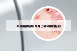 牛皮癬癩蛤蟆 牛身上癬和癩的區(qū)別