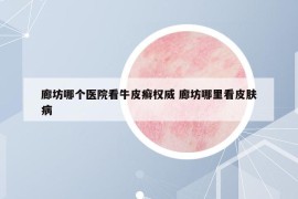廊坊哪個(gè)醫(yī)院看牛皮癬權(quán)威 廊坊哪里看皮膚病