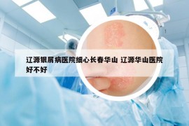 遼源銀屑病醫(yī)院細心長春華山 遼源華山醫(yī)院好不好