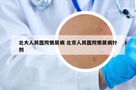 北大人民醫(yī)院銀屑病 北京人民醫(yī)院銀屑病針劑
