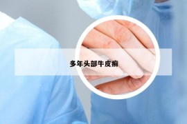 多年頭部牛皮癬