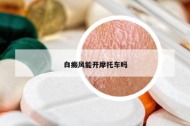 白癜風(fēng)能開摩托車嗎