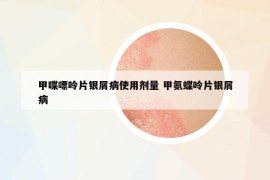 甲喋嘌呤片銀屑病使用劑量 甲氨蝶呤片銀屑病