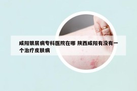 咸陽銀屑病專科醫(yī)院在哪 陜西咸陽有沒有一個治療皮膚病