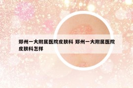 鄭州一大附屬醫(yī)院皮膚科 鄭州一大附屬醫(yī)院皮膚科怎樣