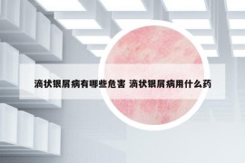 滴狀銀屑病有哪些危害 滴狀銀屑病用什么藥