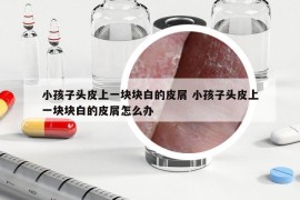 小孩子頭皮上一塊塊白的皮屑 小孩子頭皮上一塊塊白的皮屑怎么辦