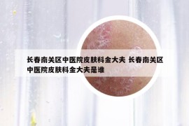 長春南關(guān)區(qū)中醫(yī)院皮膚科金大夫 長春南關(guān)區(qū)中醫(yī)院皮膚科金大夫是誰