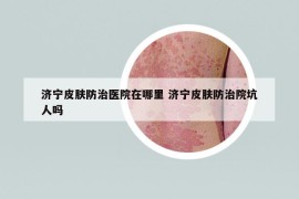 濟(jì)寧皮膚防治醫(yī)院在哪里 濟(jì)寧皮膚防治院坑人嗎