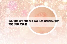 商丘銀屑病?？漆t(yī)院首選商丘銀屑病?？漆t(yī)院首選 商丘皮膚病