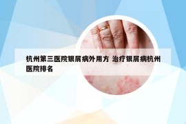 杭州第三醫(yī)院銀屑病外用方 治療銀屑病杭州醫(yī)院排名