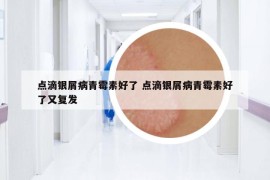 點滴銀屑病青霉素好了 點滴銀屑病青霉素好了又復發(fā)