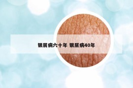 銀屑病六十年 銀屑病40年