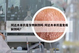 阿達(dá)木單抗是生物制劑嗎 阿達(dá)木單抗是免疫制劑嗎?