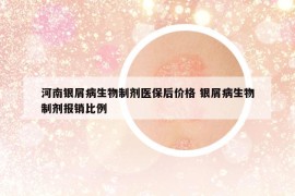 河南銀屑病生物制劑醫(yī)保后價格 銀屑病生物制劑報銷比例