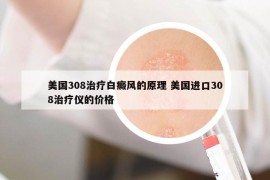 美國308治療白癜風的原理 美國進口308治療儀的價格