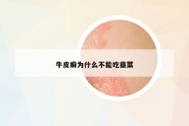 牛皮癬為什么不能吃韭菜
