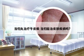 當(dāng)歸丸治療牛皮癬 當(dāng)歸能治皮膚疾病嗎?